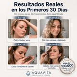 Aquavita™ | Regadera con Filtro + 5 Filtros GRATIS